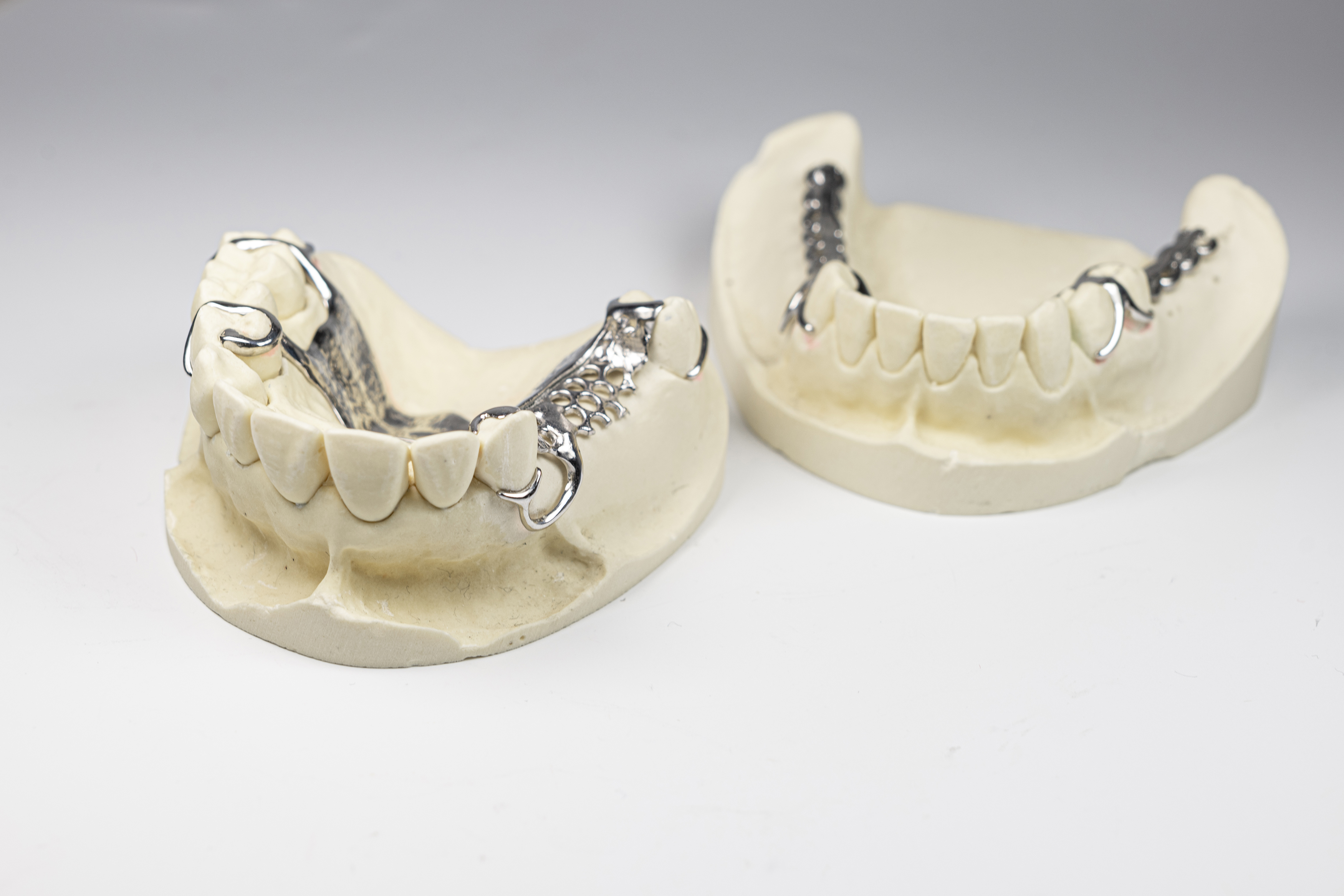 Zahnprothesen wie diese entstehen aktuell in aufwendiger Handarbeit. »ATeM« will die Herstellung komfortablerer Prothesen schneller, kostensparender und ressourcenschonender gestalten.