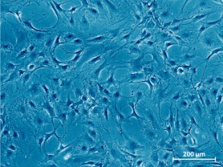 Microscope image of healthy cartilage cells. 