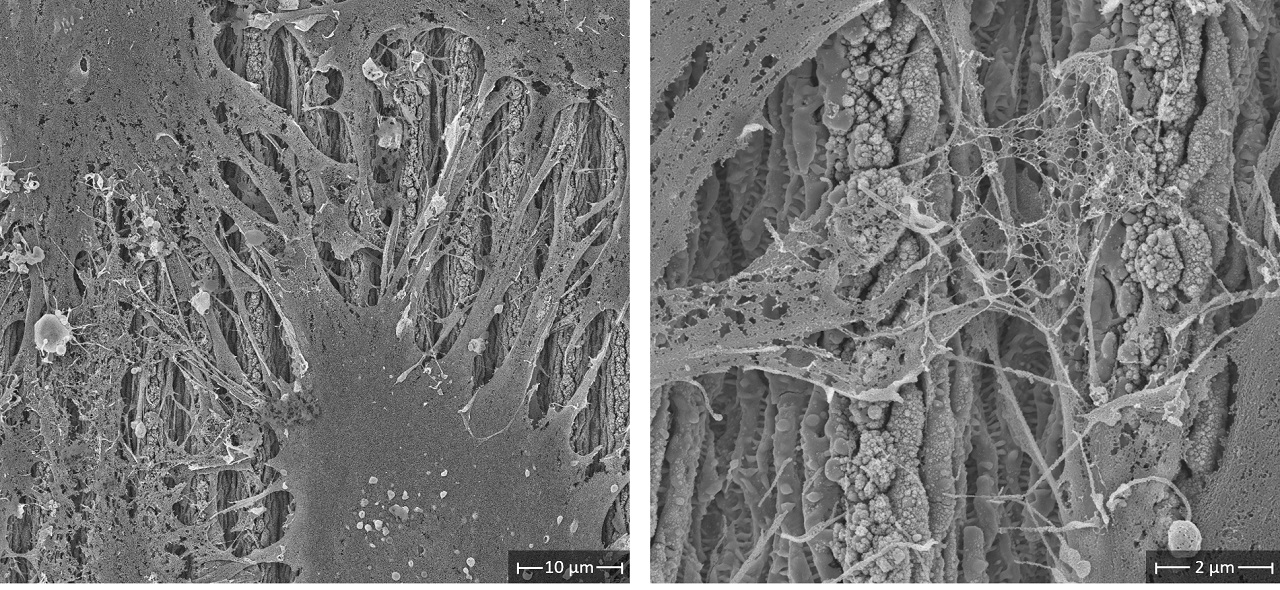 Scanning electron microscope images of the growth behavior of human bone marrow stromal stem cells on DLIP-structured Ti-13Nb-13Zr surfaces after four hours of cultivation. The surface structure exhibits hierar-chical elements consisting of the primary DLIP structure as well as high and low spatial frequency LIPSS. The cells form fine outgrowths that anchor themselves to the structures.